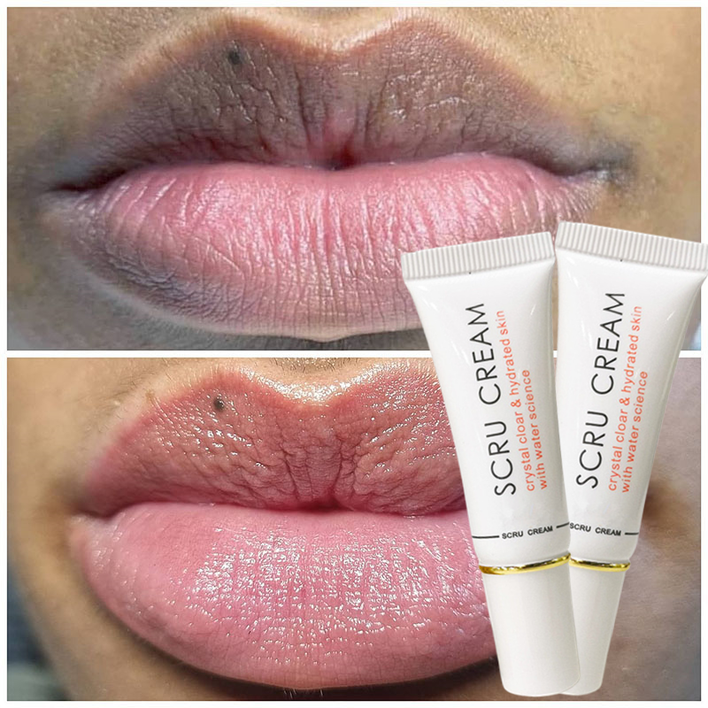 Scrub Dark Black Lip Removal Pigmentation Fade Dull Pink Lip Balm Brighten Anti-Crack Moisturizing