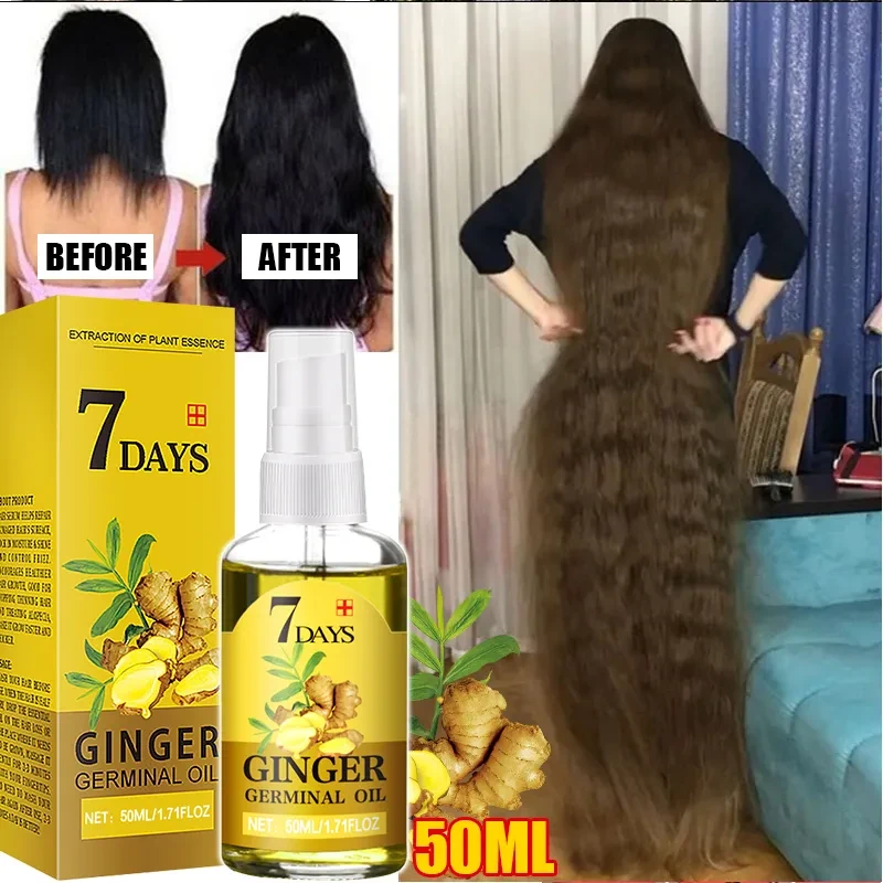 Ginger Oil 7-days Fast Hair Growth for Men Women Anti Hair Loss Treatment Scalp Serum  50ML