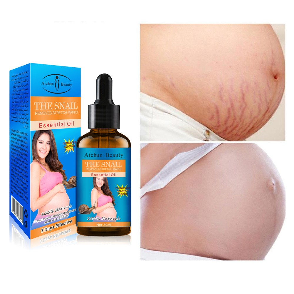 Aichun Beauty Natural Snail Removes Pregnancy Stretch Marks Essential Oil  (30 ml)