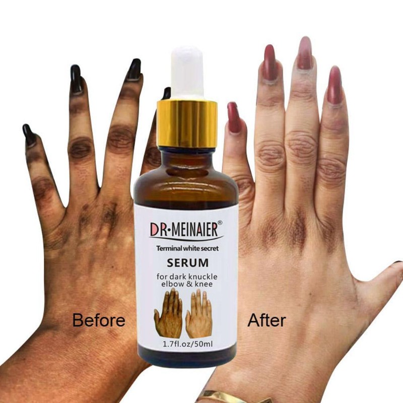 Whitening Moisturizing Glow Serum for Removing Dark Knuckle Elbow Knee Strong Dark Knuckle Serum Unisex (50ml)