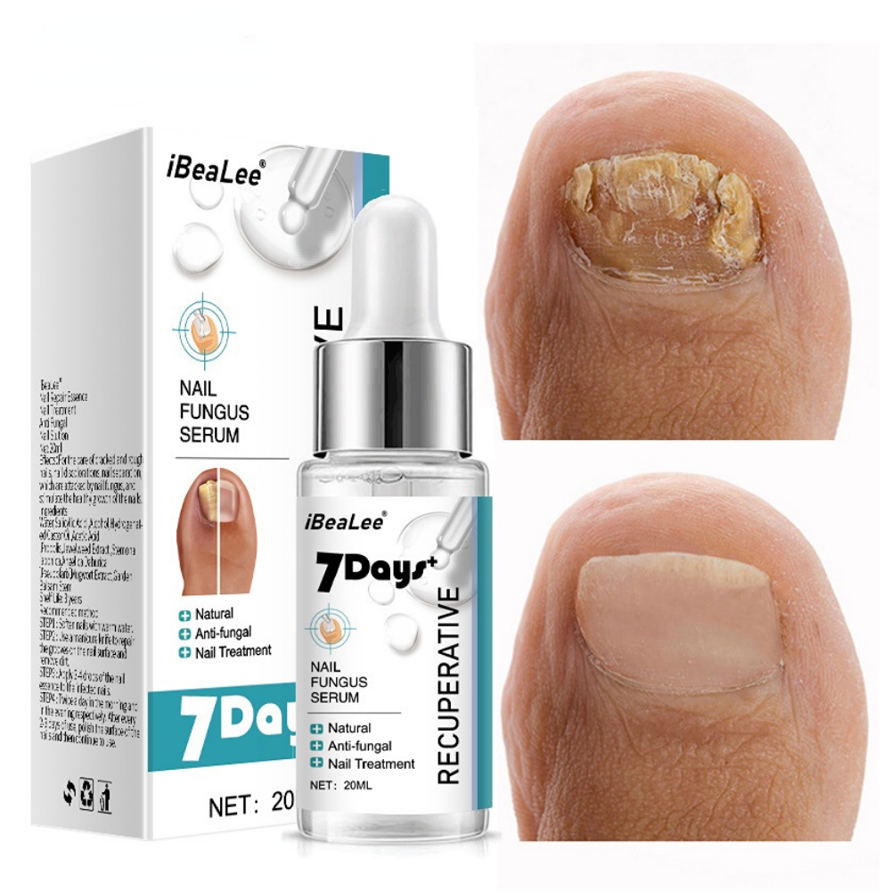 Nail Fungus Treatments Serum Anti-Infection 7DAYS Repair Foot Onychomycosis Paronychia Toe Care Nails Fungal Removal