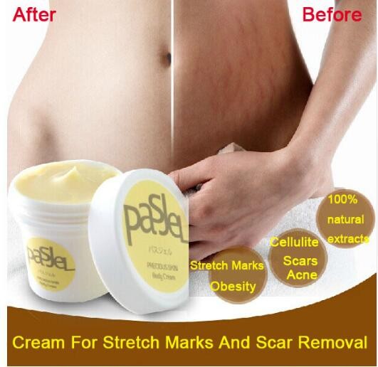 PASJEL stretch marks removal of scar cream slack line firming lifting skin stretch mark repair cream