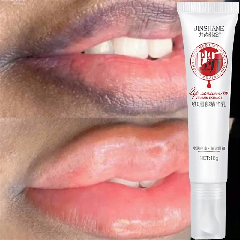 Pink Lip Cream Whitening Balm Moisturizing Nourishing Essence Remove Dark Smoke Rose