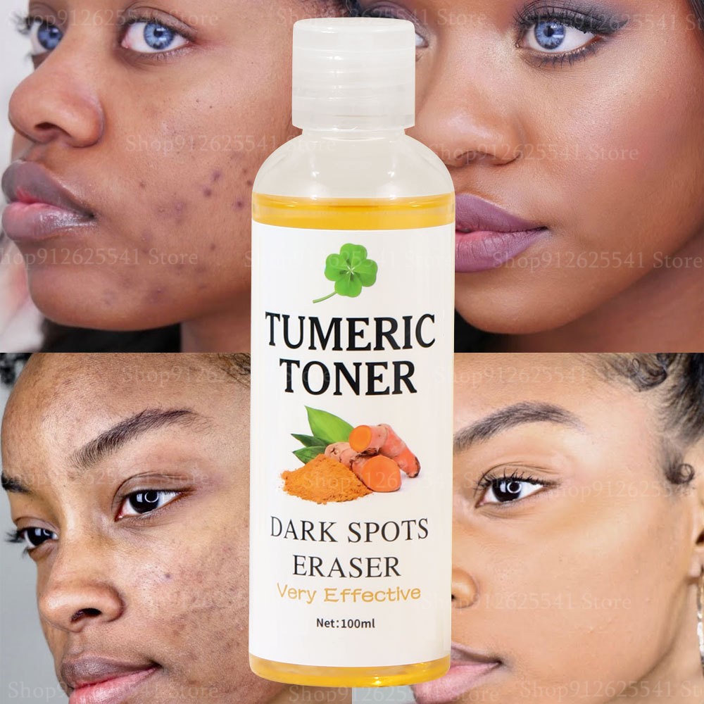 Dark Spot Eraser Natural Turmeric Toner Strong Facial Tightener Black Skin Tone Flawless Skin Care 100ml