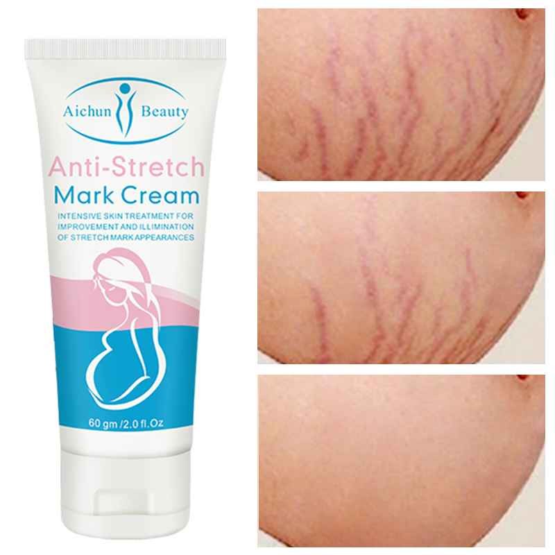 Snail Stretch Mark Cream Removal Stretch Marks Repair Skin Anti-Wrinkle Anti-Aging Lifting Firming Body Care