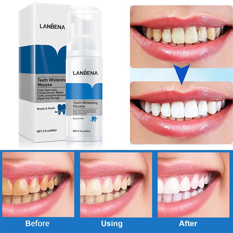 LANBENA Teeth Whitening Mousse Oral Hygiene Dental Bleaching Care