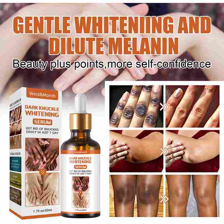 Knee and Ankle Lightening Brightening Melanin Skin Tone Moisturizing Rejuvenation